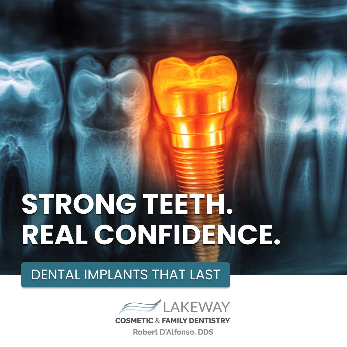 Lakeway Cosmetic & Family Dentistry — Facebook Ad Design Dental implant Facebook ad design example