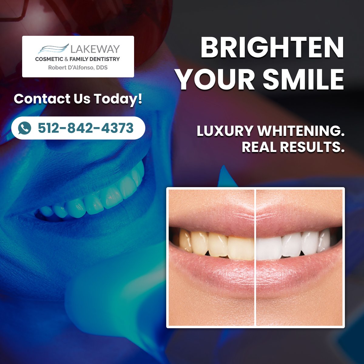 Lakeway Cosmetic & Family Dentistry — Facebook Ad Design Luxury teeth whitening Facebook ad design example